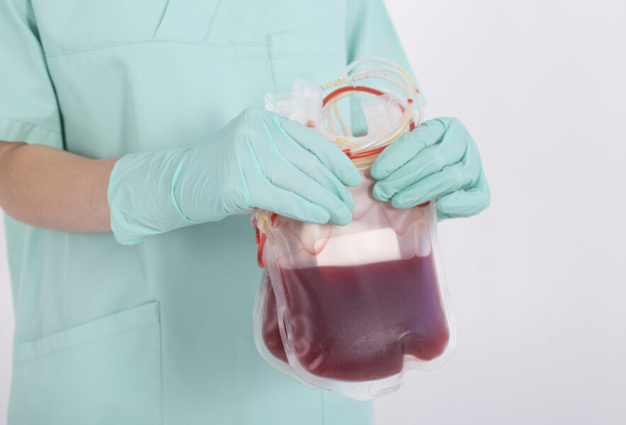 造血幹細胞移植の治療の流れは？