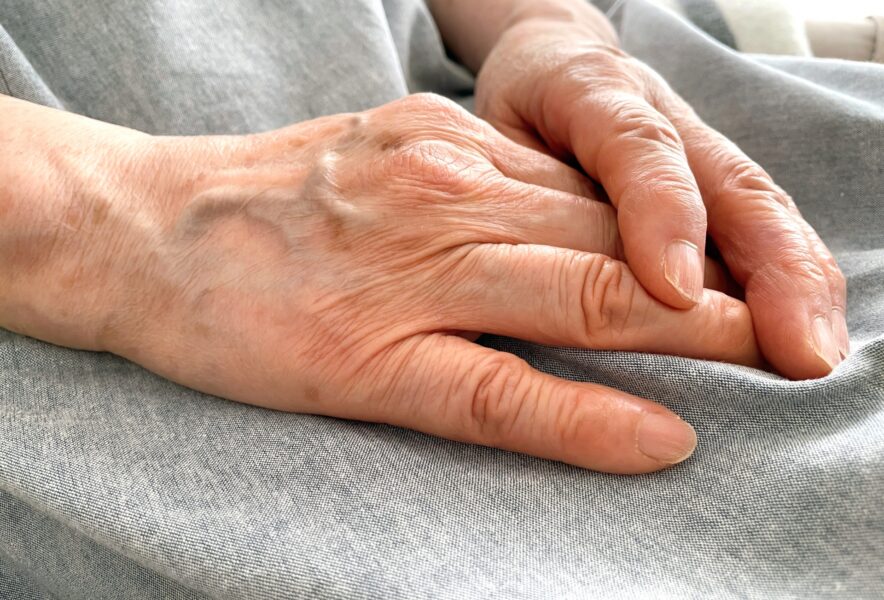 関節リウマチで手がこわばる？具体的な症状や治療法を解説します